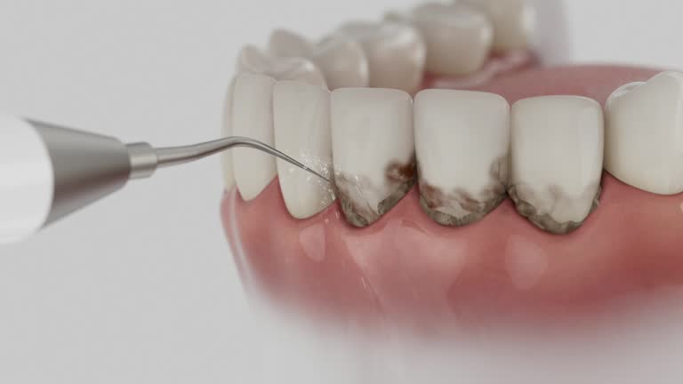 Reliable Dental contractor in Aurora, MN by Smile Center Dentistry